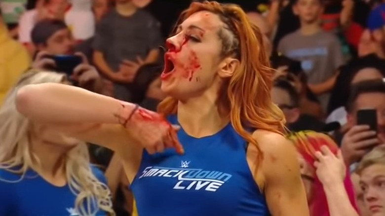 Becky Lynch bloody nose
