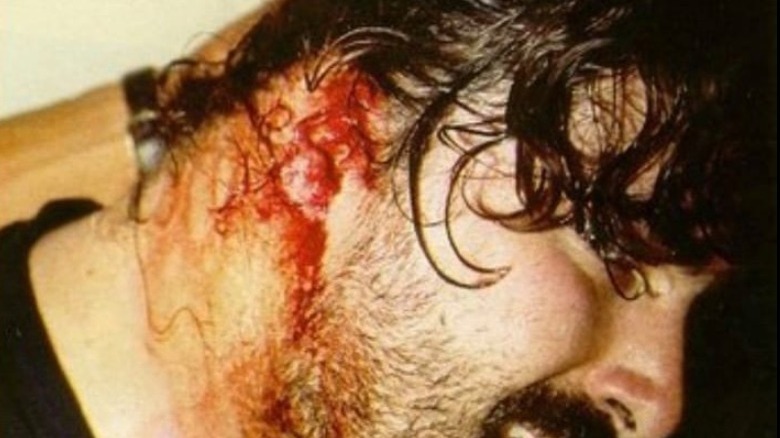 mick foley's missing ear